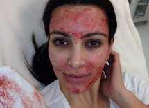 15 cool crazy and super expensive celebrity beauty treatments 2