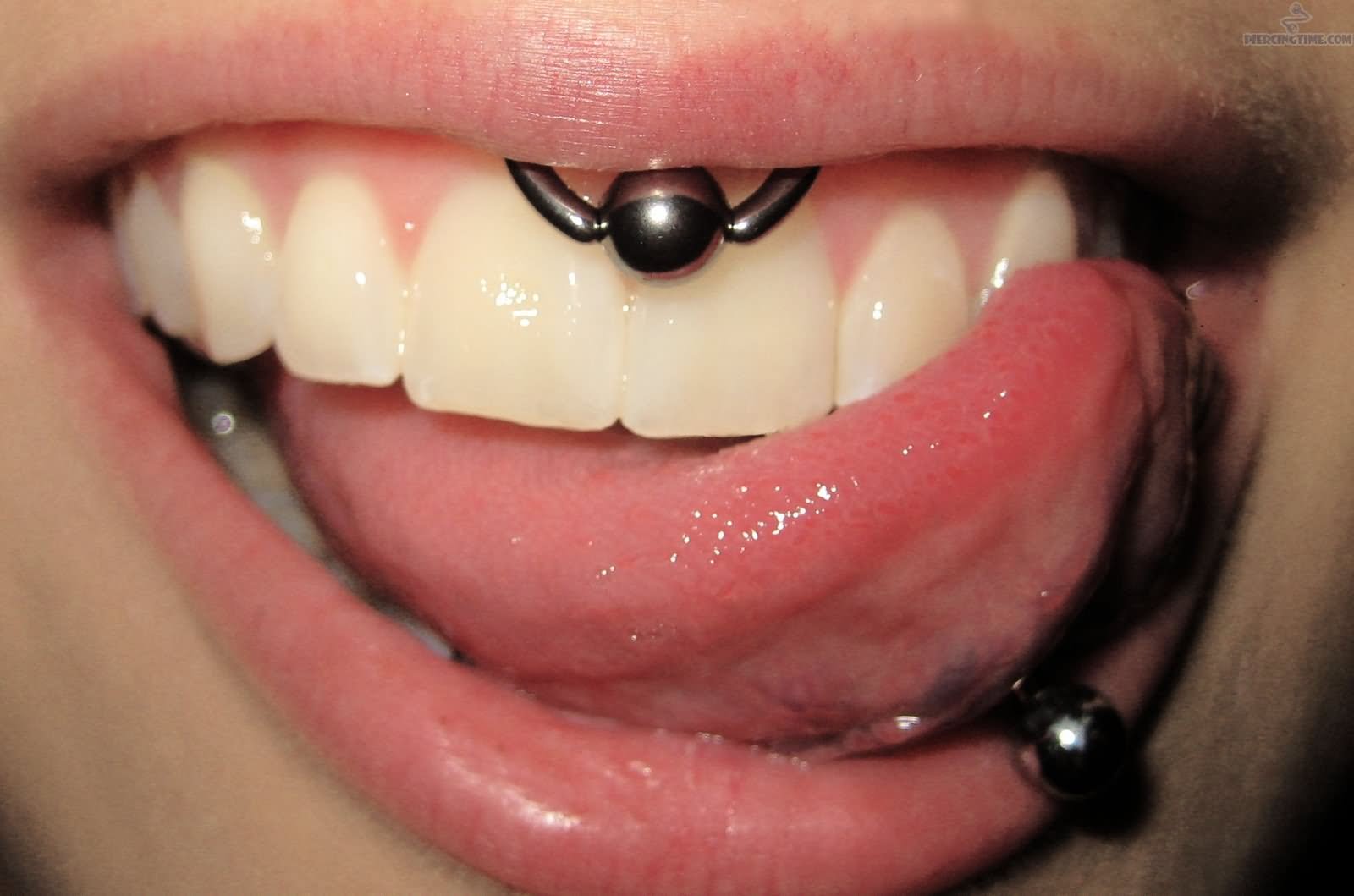 tongue and ball ring smiley piercing
