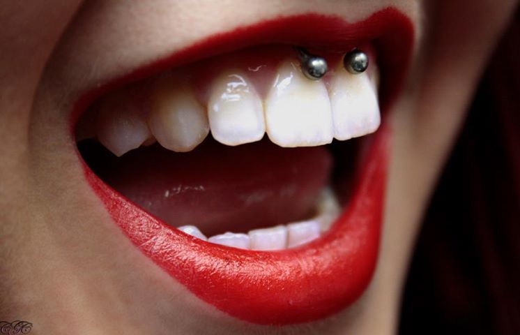 Smiley Piercing