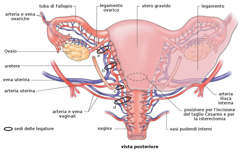 Quali sono sintomi tumore all'utero