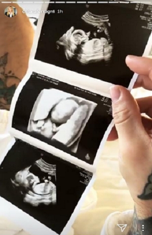 ecografia chiara ferragni