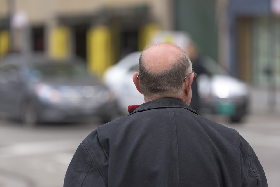 caduta dei capelli