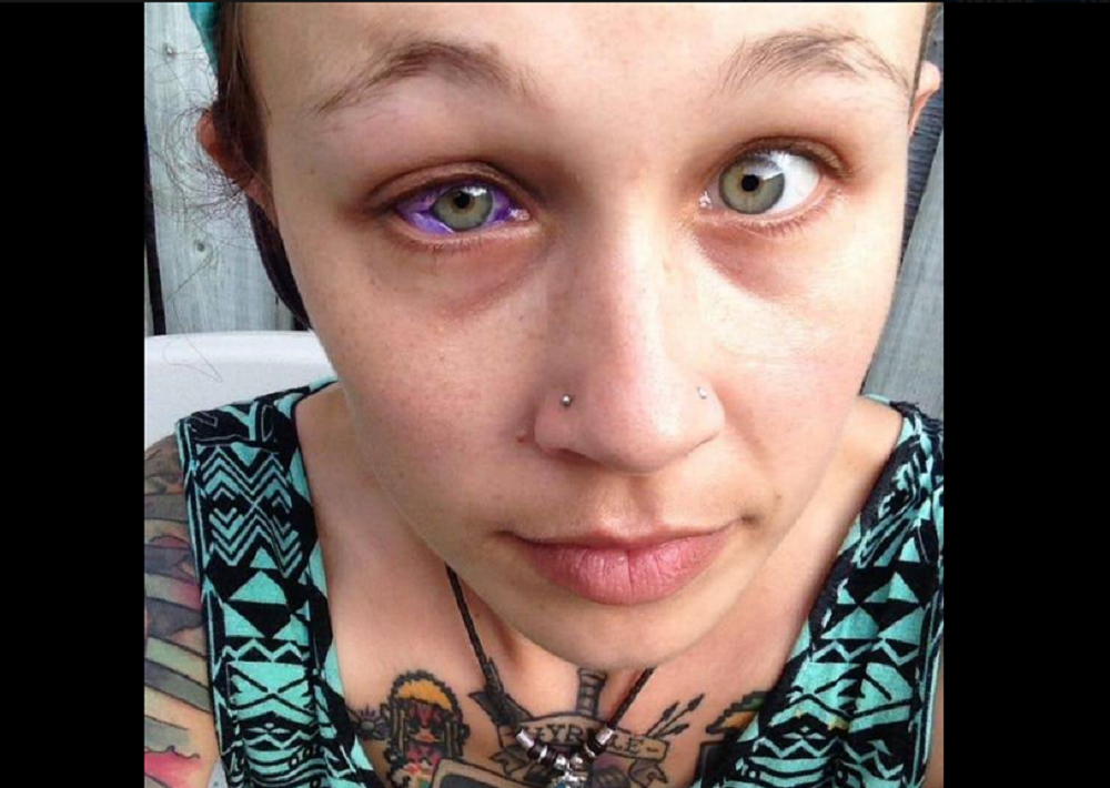 Modella rischia di diventare cieca per tatuaggio oculare