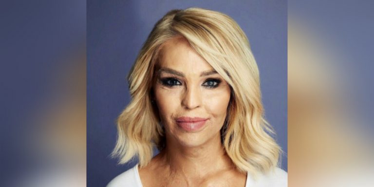 Katie Piper