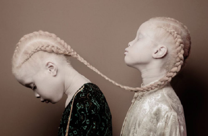 modelle gemelle albine