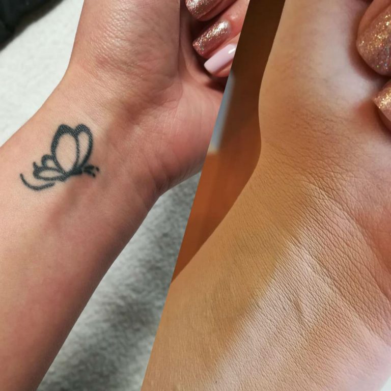 come coprire un tatuaggio