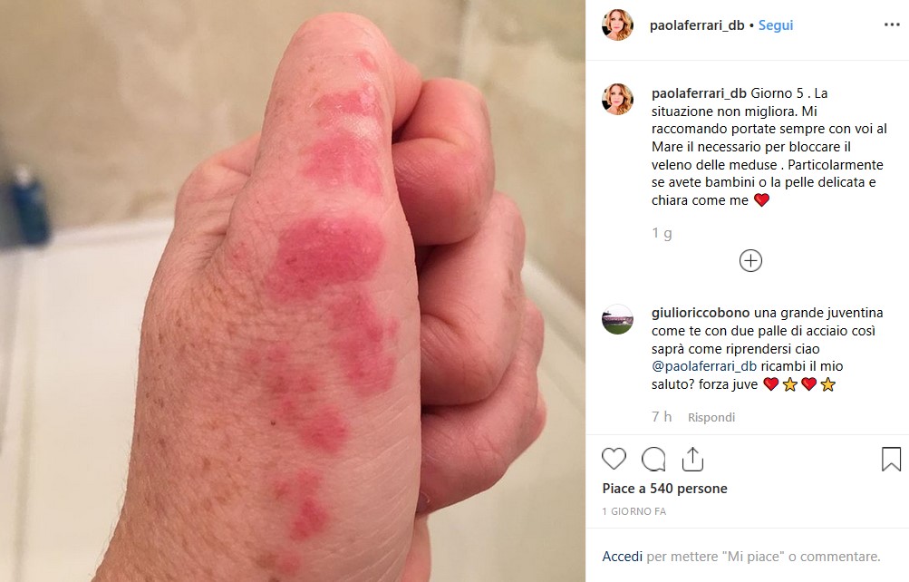 paola ferrari incidente