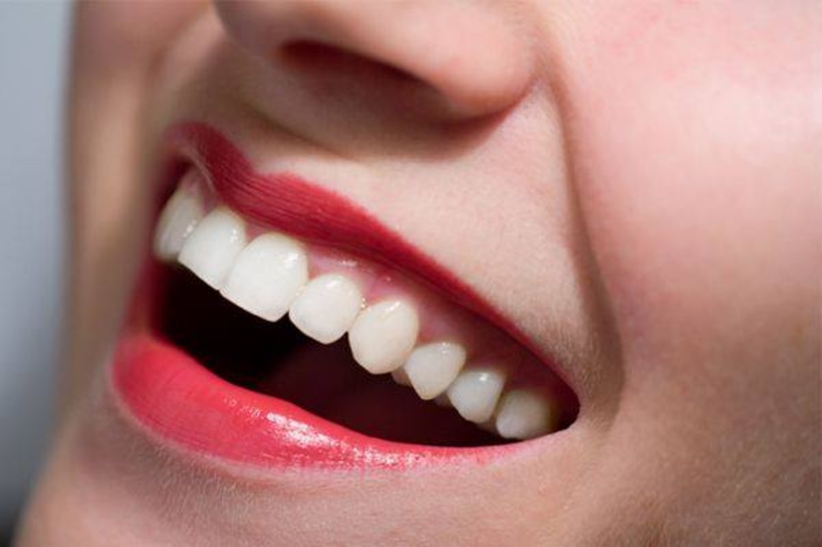 denti bianchi e sani