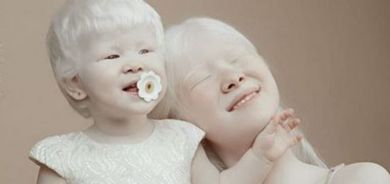 sorelle albine