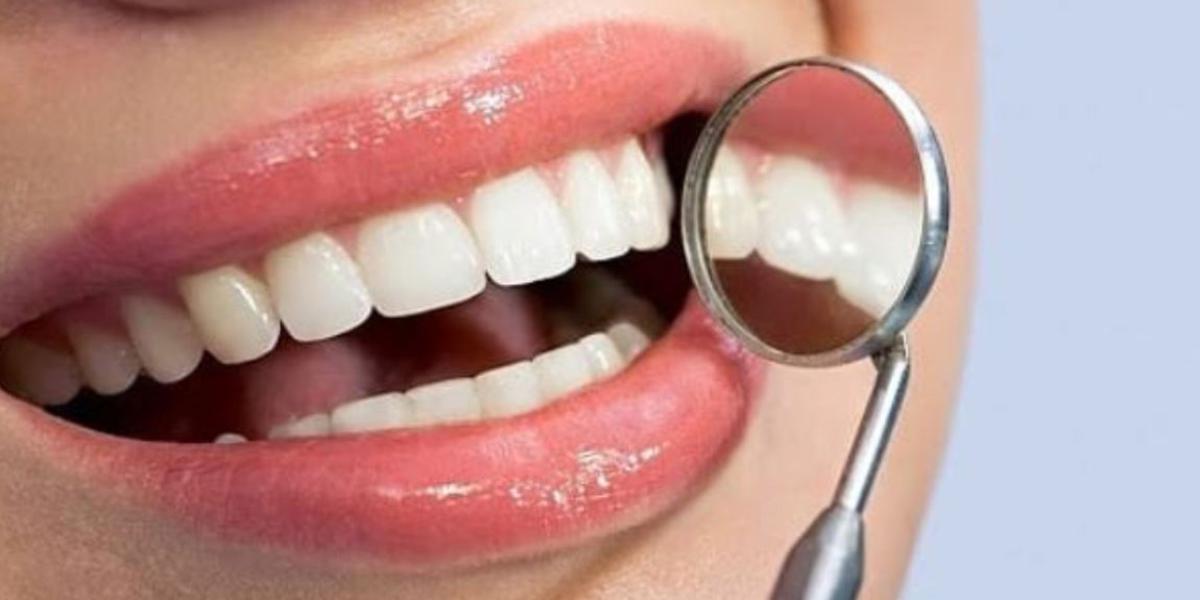 sbiancare denti con acqua ossigenata