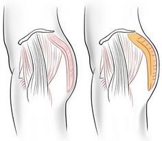 stretching glutei come fare