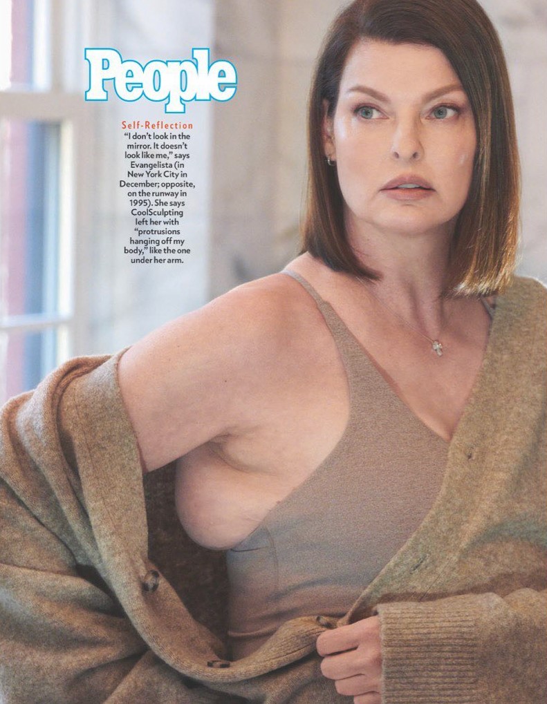 linda evangelista sfigurata