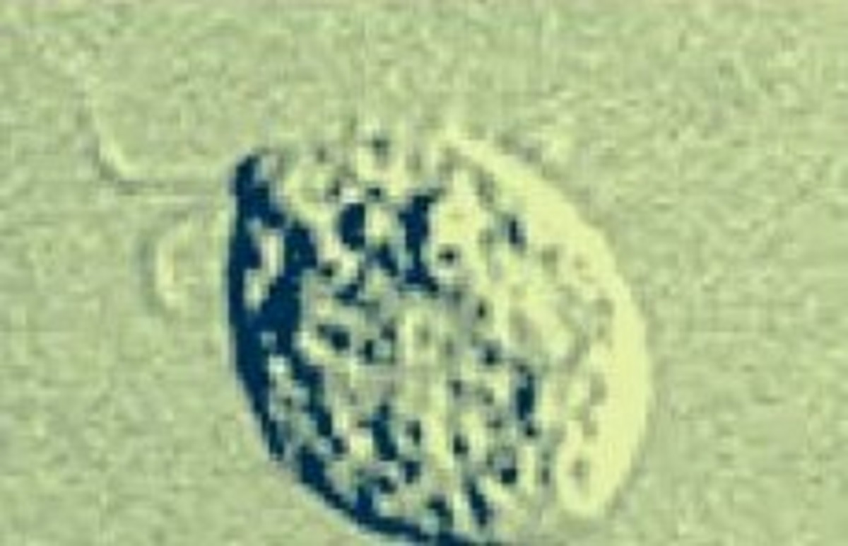 Uno dei tre stadi dell'ameba