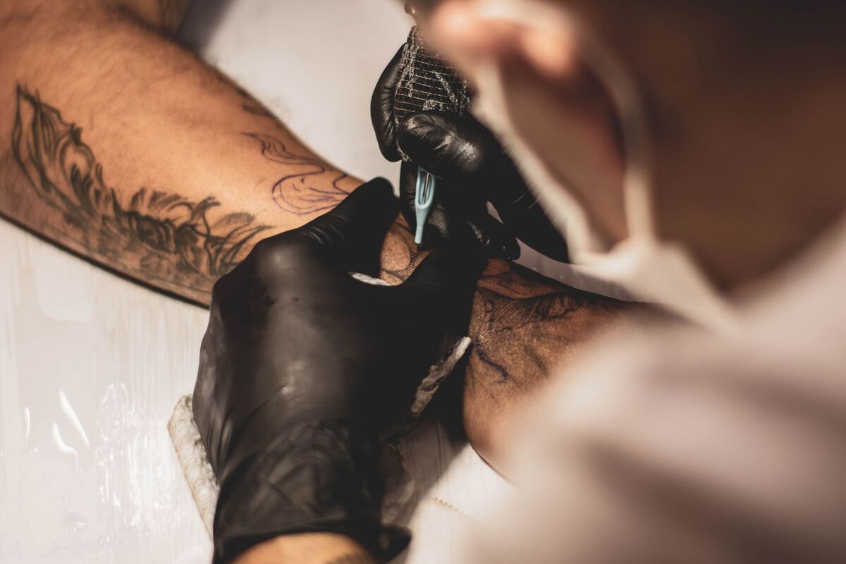 Tutti i motivi dietro la rimozione di un tattoo