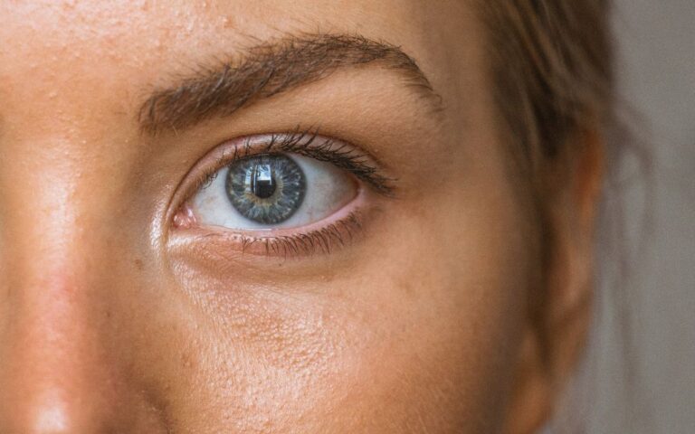 Come eliminare le occhiaie: soluzioni semplici da provare