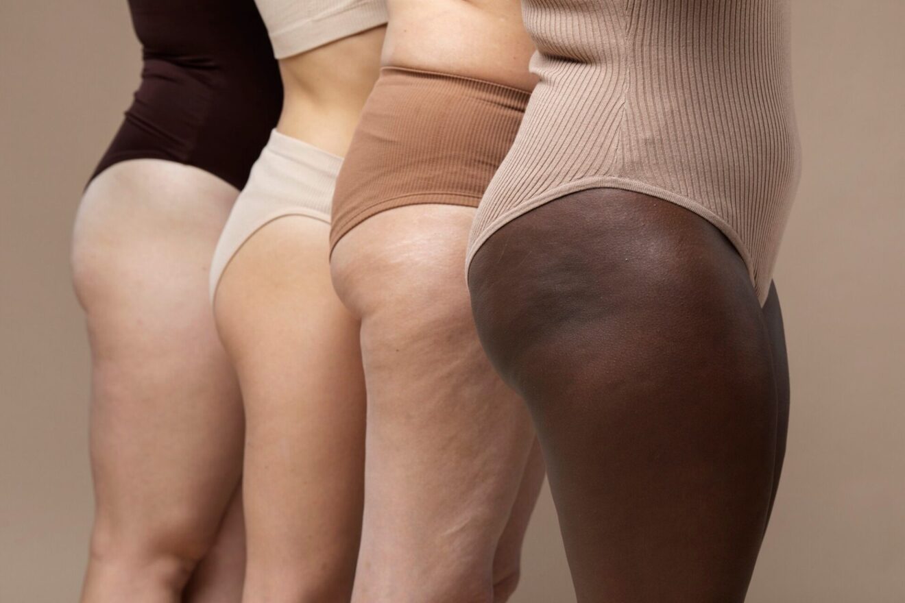 prova costume e cellulite